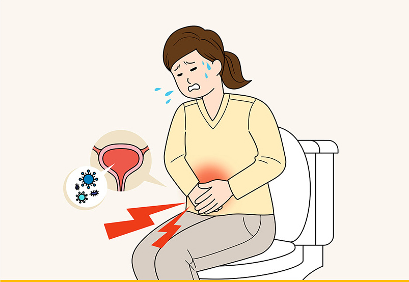 '앙변기에서 배를 움켜쥐고 고통스러워하는 여자'의 모습을 보여준다. 여자 옆 그림풍선에는 '방광에 세균이 들어간걸 볼 수 있다.'