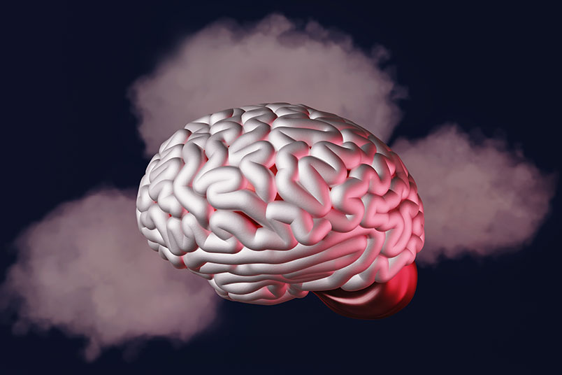 '뇌'의 3D 이미지로써 '측두엽'과 뿌연 안개가 낀 듯한 느낌을 전달하고 있다.