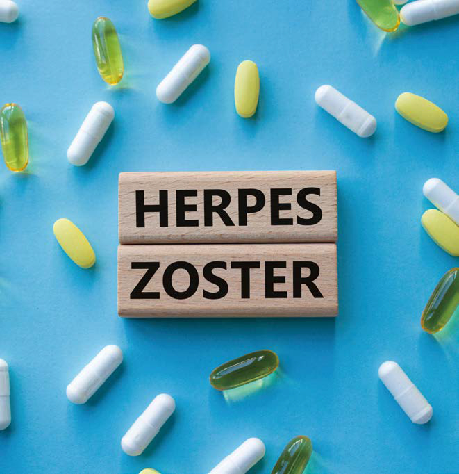 'HERPES ZOSTER' 단어가 가운데 써있는 블록이 놓여져 있다. 주변에는 알약과 캡슐이 흩어져있다.